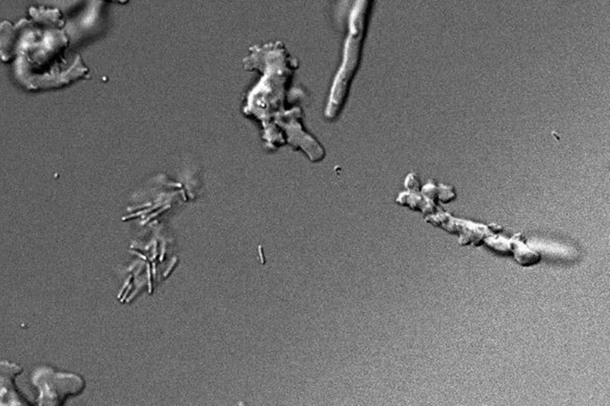 Ameba encontrada na Califórnia se reproduz em calor de até 63 ºC