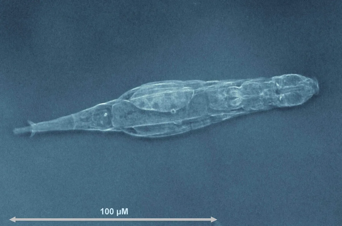Rotífero reconstrói DNA danificado ao longo de gerações, mostra estudo